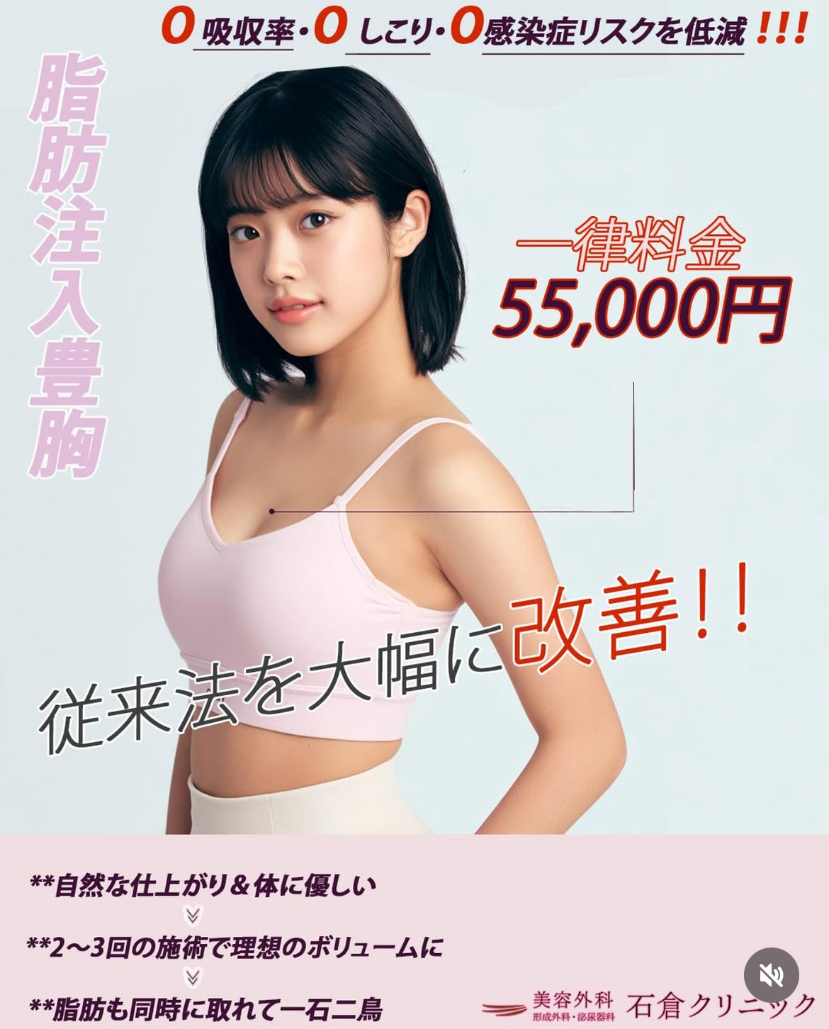 脂肪注入豊胸