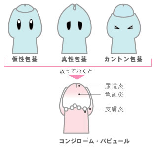 脂肪吸引例